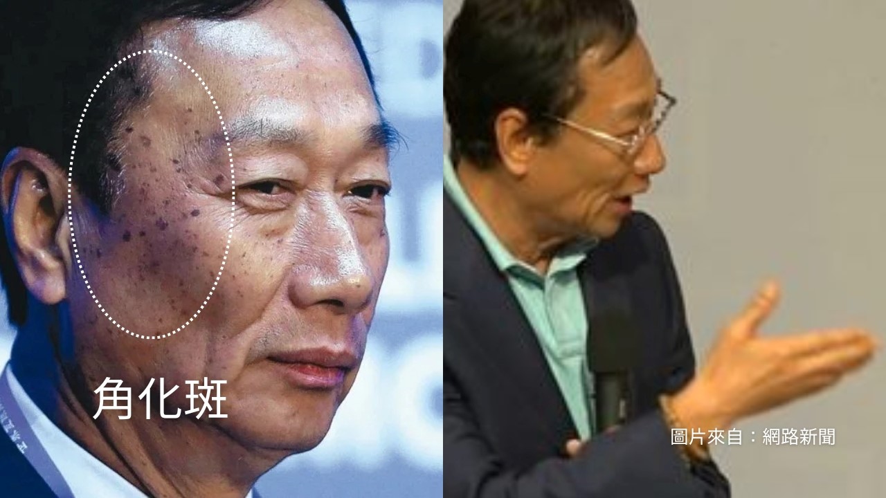 女比男老得快？男人幾歲開始老化？