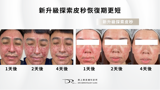 生長因子是什麼？EGF或外泌體保養品是什麼？有效嗎?