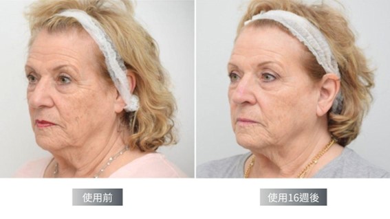 Cyspera希思珮樂淡斑乳霜有解！希思珮樂一代到三代差異比較一次看懂！