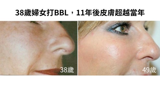 更年期如何保持年輕？雌激素下降會怎樣？十大關鍵報你知！