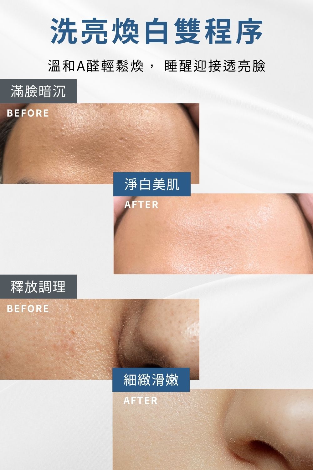 DRX達特仕的莊醫師嚴選活動專區系列-1+1淨緻煥白組，從正確洗淨的第一道保養工序銜接0.3%A醛中階煥膚，輕鬆搭建肌地，感受前所未有的滑嫩透亮。限時小資加碼下單贈〈超淨化溫和洗面凝膠隨身瓶〉！