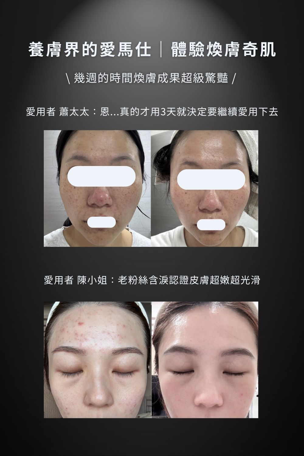 DRX達特仕的莊醫師嚴選活動專區系列-DRX 0.5%維A極淨煥膚亮白乳，淡化細紋、恢復肌膚彈性