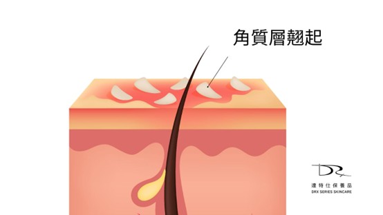 如何讓皮膚快速修復？皮膚修復成分大揭密！
