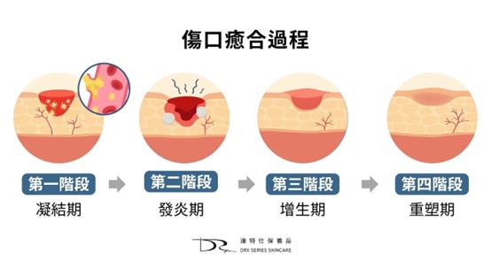 無論是不小心擦傷、騎機車雷殘或是打完雷射後的傷口會不會演變成疤痕，其實都跟你有沒有好好護理傷口有很大的關係，今天就讓我們來探討，如何正確護理傷口、讓傷口快速癒合，然後用哪些產品能減少疤痕產生吧！