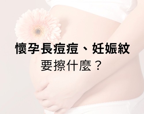 懷孕長痘痘可以擦什麼？妊娠紋要擦什麼？