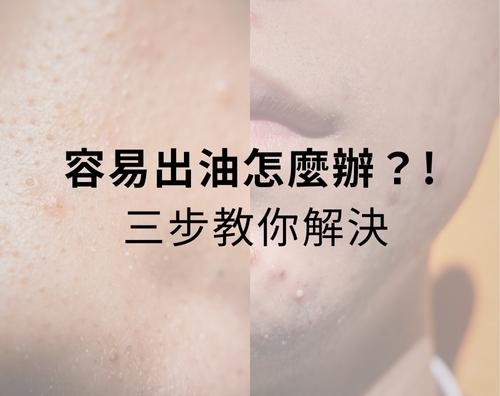 早上精心上好妝，中午卻已經油光滿面、妝感崩壞？一整天下來，T字區像自帶打亮，毛孔還越看越明顯，偶爾還伴隨粉刺、青春痘突襲，當油脂分泌過多，就會引發粉刺、痘痘、毛孔粗大等困擾，所以讓油水平衡，既保留皮膚的天然保護力，又避免油光滿面，這才是健康肌膚的最佳狀態！