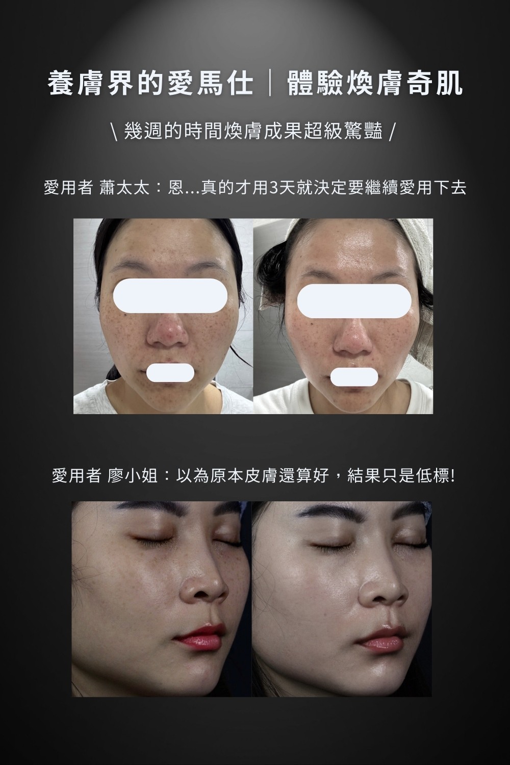 DRX達特仕的維他命C系列-DRX 0.5%維A極淨煥膚亮白乳，針對30歲以上、耐受性肌膚設計的抗老美白A醇。