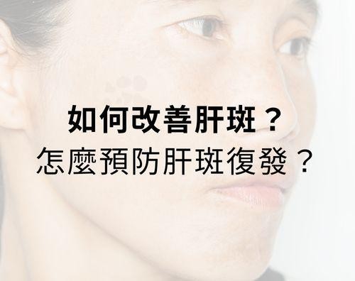 如何改善肝斑？如何預防肝斑復發？