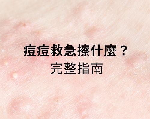 長青春痘時，很多人第一個想法是：我要擦什麼才能消掉痘痘？但其實，痘痘的成因不同，對應的外用方案也不一樣。與其亂買保養品，不如先看看皮膚科醫師常用、真正有效的成分清單！