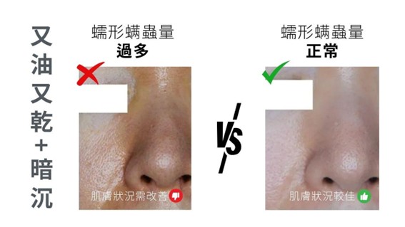 乾到出油?先別急著擦保濕！