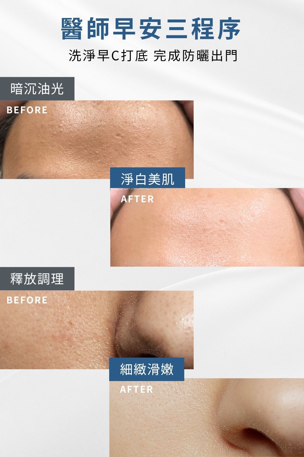 要挑選保濕防曬系列商品就到DRX達特仕，DRX達特仕的醫師早安套組(潤色)，以水楊酸棉片清潔後，導入早C覆蓋屏障，最後一步搭建防曬系統，完美定義外出前奏。要買防曬乳、防曬系列商品，就到DRX達特仕。
