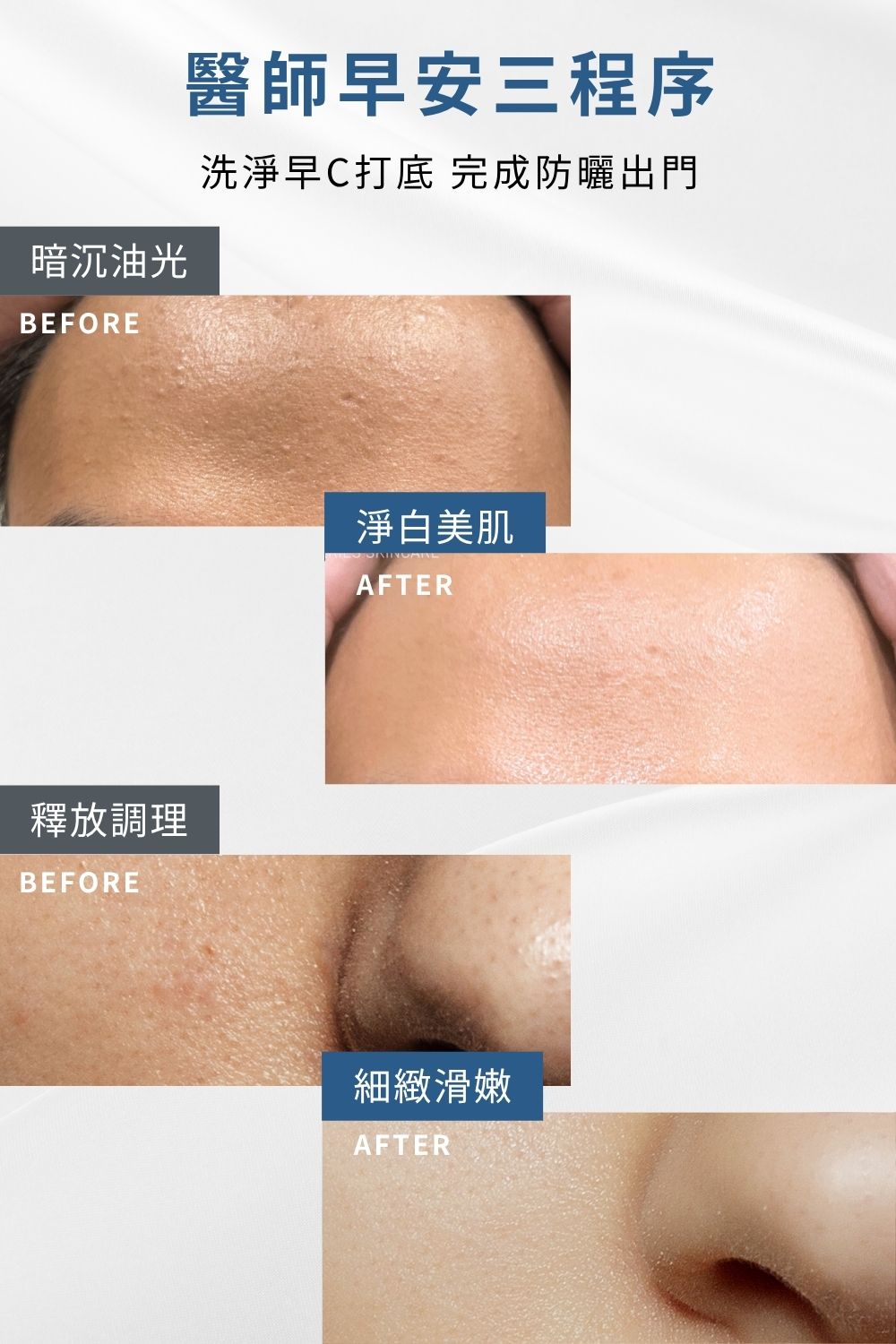 DRX達特仕的醫師早安套組(透明)，以水楊酸棉片清潔後，導入早C覆蓋屏障，最後一步搭建防曬系統，完美定義外出前奏。要買防曬乳、防曬系列商品，就到DRX達特仕。