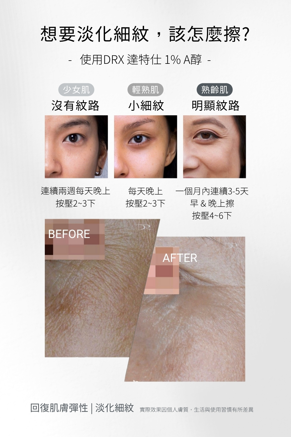 DRX達特仕給您最好的煥膚產品,DRX達特仕的DRX 1%煥顏A醇,解決您的肌膚問題,可以延緩衰老、改善膚質、改善粉刺、改善青春痘、改善皮膚暗沈、改善膚色不均,透過特殊技術,使皮膚代謝效果更上一層樓! DRX達特仕給您最好的煥膚產品,DRX達特仕的DRX 1%煥顏A醇,解決您的肌膚問題,可以延緩衰老、改善膚質、改善粉刺、改善青春痘、改善皮膚暗沈、改善膚色不均,透過特殊技術,使皮膚代謝效果更上一層樓!