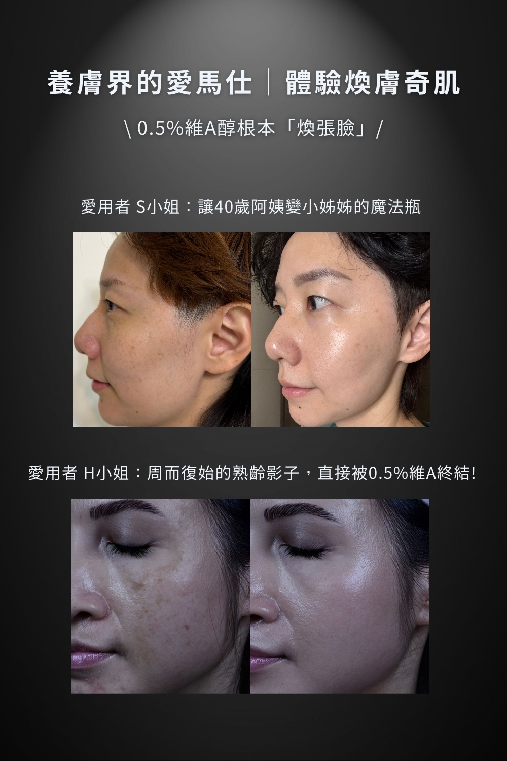 DRX達特仕的EGF保養品系列-DRX 0.5%維A極淨煥膚亮白乳,針對30歲以上、耐受性肌膚設計的抗老美白A醇。 DRX達特仕的EGF保養品系列-DRX 0.5%維A極淨煥膚亮白乳,針對30歲以上、耐受性肌膚設計的抗老美白A醇。