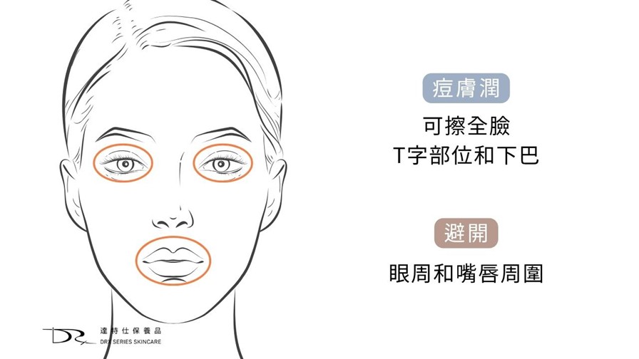 痘膚潤 Differin Gel 的主要成分是 adapalene(阿達帕林),屬於 第三代 A 酸。痘膚潤是少數可在藥局直接購買的 A 酸藥膏。很多人都疑惑痘膚潤的正確用法是什麼? 要如何與其它抗痘保養品搭配,還有順序要怎麼擦呢? 痘膚潤 Differin Gel 的主要成分是 adapalene(阿達帕林),屬於 第三代 A 酸。痘膚潤是少數可在藥局直接購買的 A 酸藥膏。很多人都疑惑痘膚潤的正確用法是什麼? 要如何與其它抗痘保養品搭配,還有順序要怎麼擦呢?