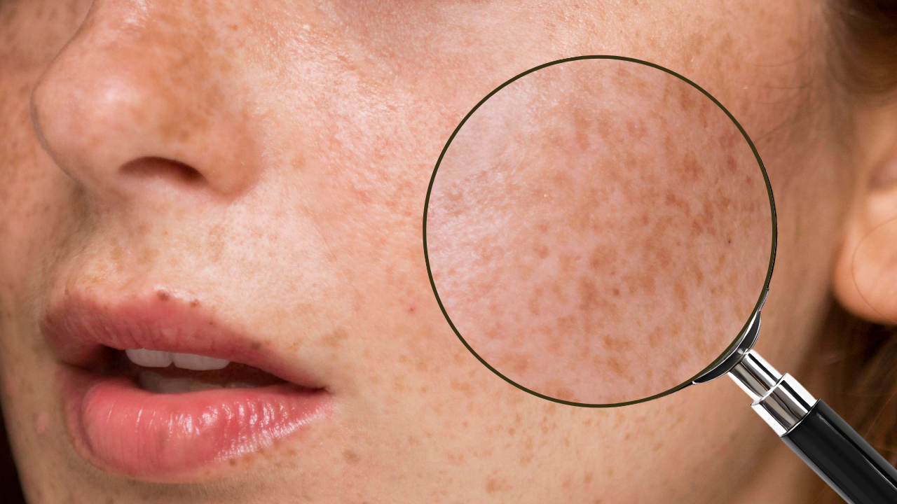 光解酶是什麼？光解酶保養品推薦！