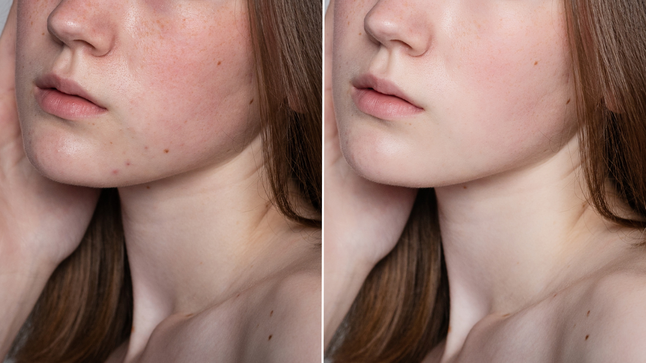 光解酶是什麼？光解酶保養品推薦！