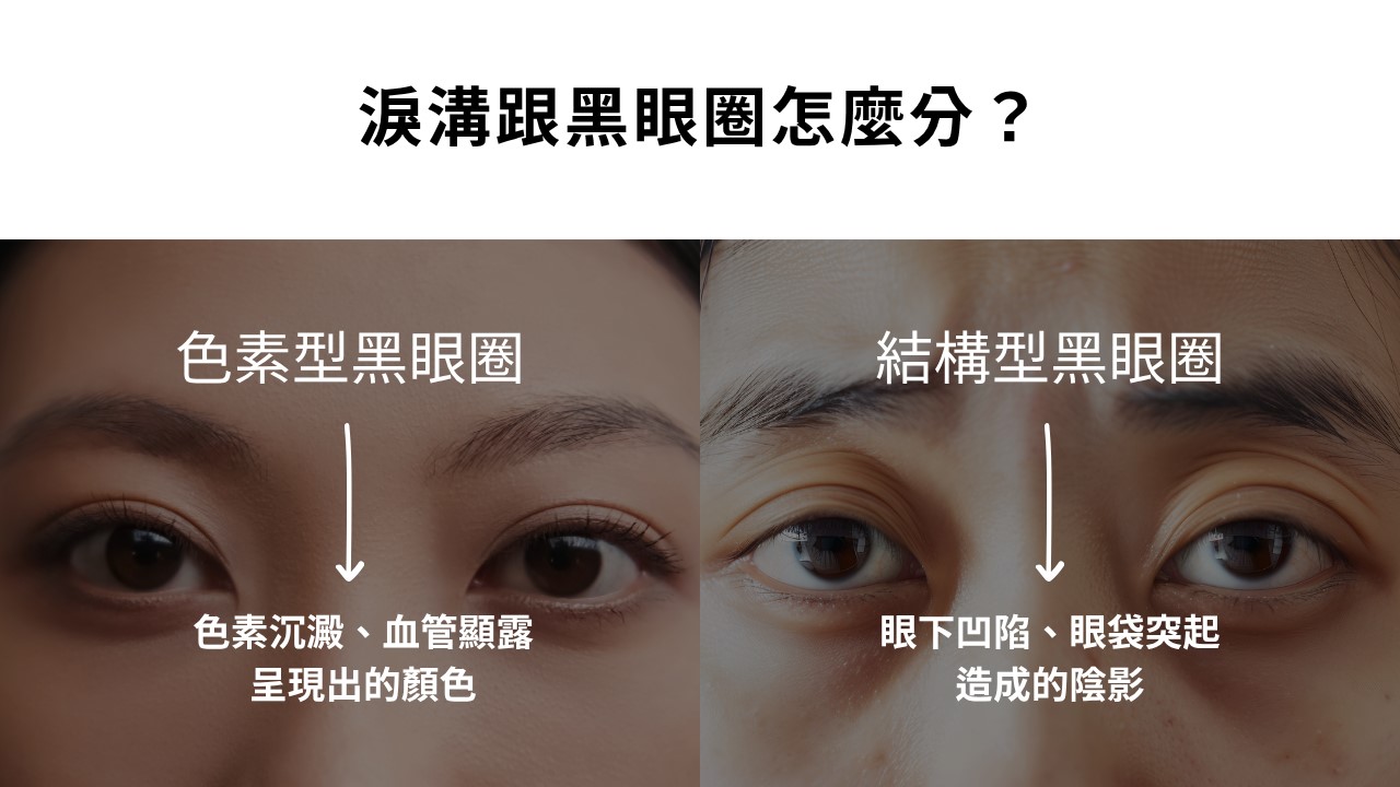 眼下遮瑕卡粉怎麼辦?黑眼圈要用什麼顏色遮? 眼下遮瑕卡粉怎麼辦?黑眼圈要用什麼顏色遮?