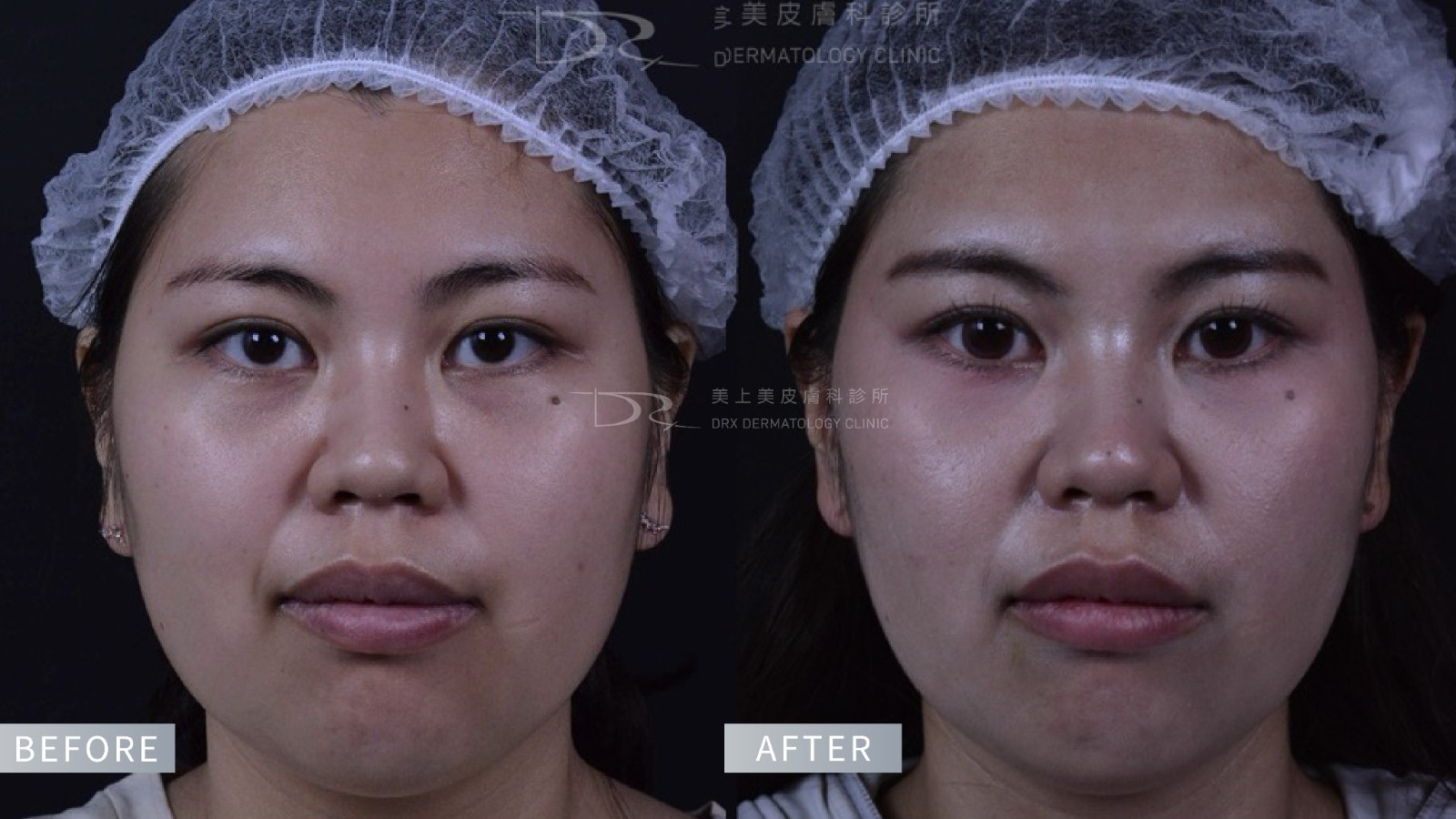 眼下遮瑕卡粉怎麼辦?黑眼圈要用什麼顏色遮? 眼下遮瑕卡粉怎麼辦?黑眼圈要用什麼顏色遮?