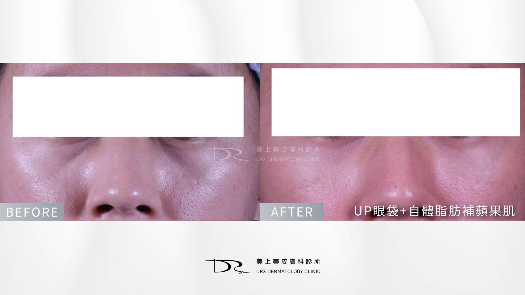 眼下遮瑕卡粉怎麼辦?黑眼圈要用什麼顏色遮? 眼下遮瑕卡粉怎麼辦?黑眼圈要用什麼顏色遮?