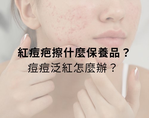 紅痘疤擦什麼保養品？痘痘泛紅怎麼辦？ 