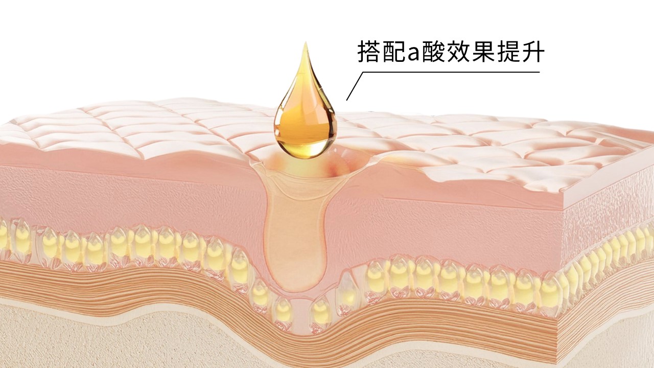 水楊酸擦完要擦什麼? 水楊酸擦完要擦什麼?