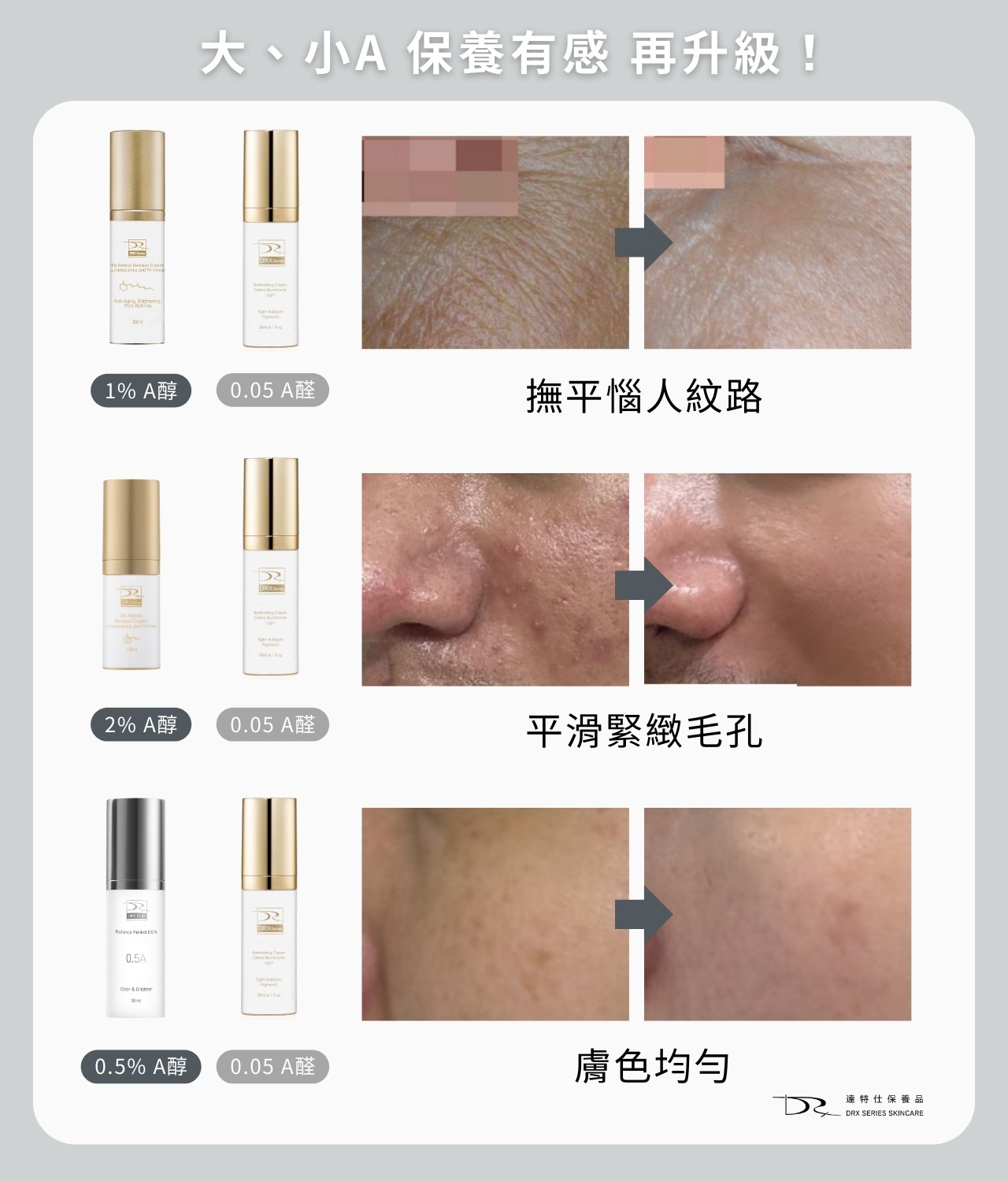 A 醇可以長期用嗎?毛孔粗大美白 A 醇用法,醫師教你「大 A、小 A」實用A醇擦法! A 醇可以長期用嗎?毛孔粗大美白 A 醇用法,醫師教你「大 A、小 A」實用A醇擦法!