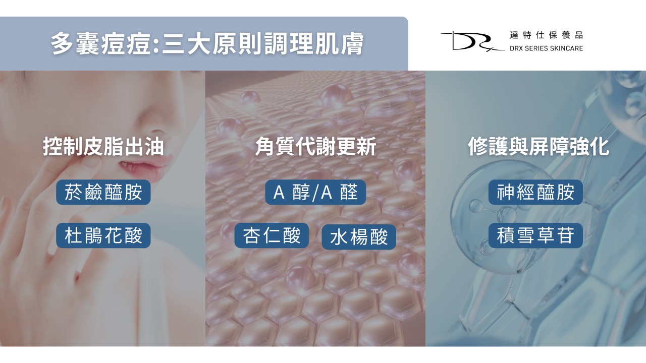 多囊痘痘怎麼辦？PCOS 痘痘原因與保養成分怎麼選