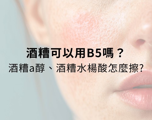 酒糟可以用B5嗎?酒糟A醛、酒糟水楊酸怎麼擦? 酒糟可以用B5嗎?酒糟A醛、酒糟水楊酸怎麼擦?
