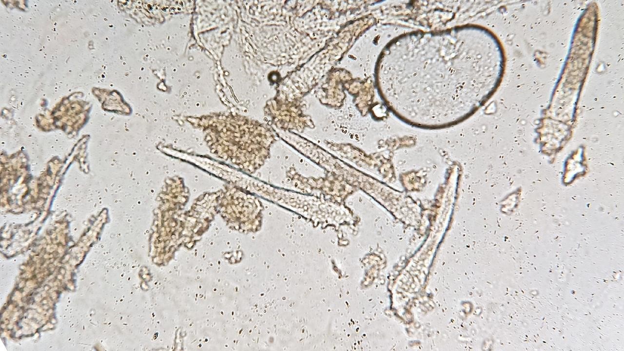 蠕形蟎蟲會傳染嗎? 蠕形蟎蟲會傳染嗎?