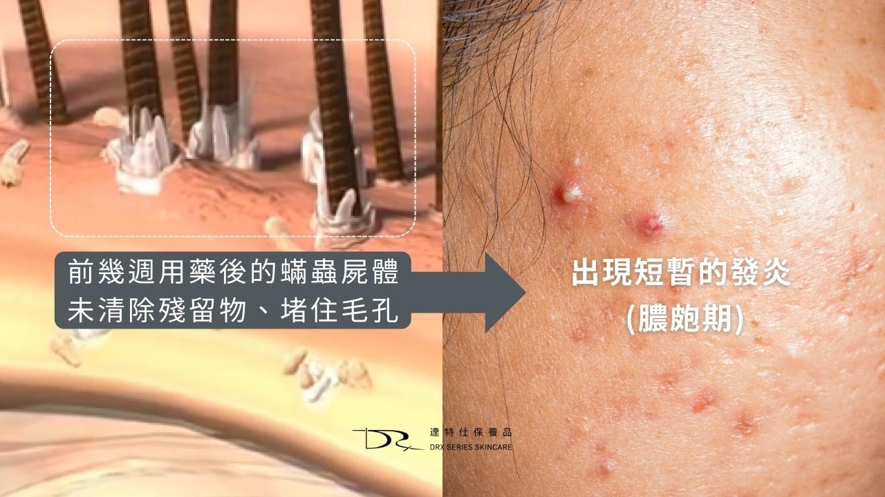 舒立達怎麼擦? 舒立達怎麼擦?