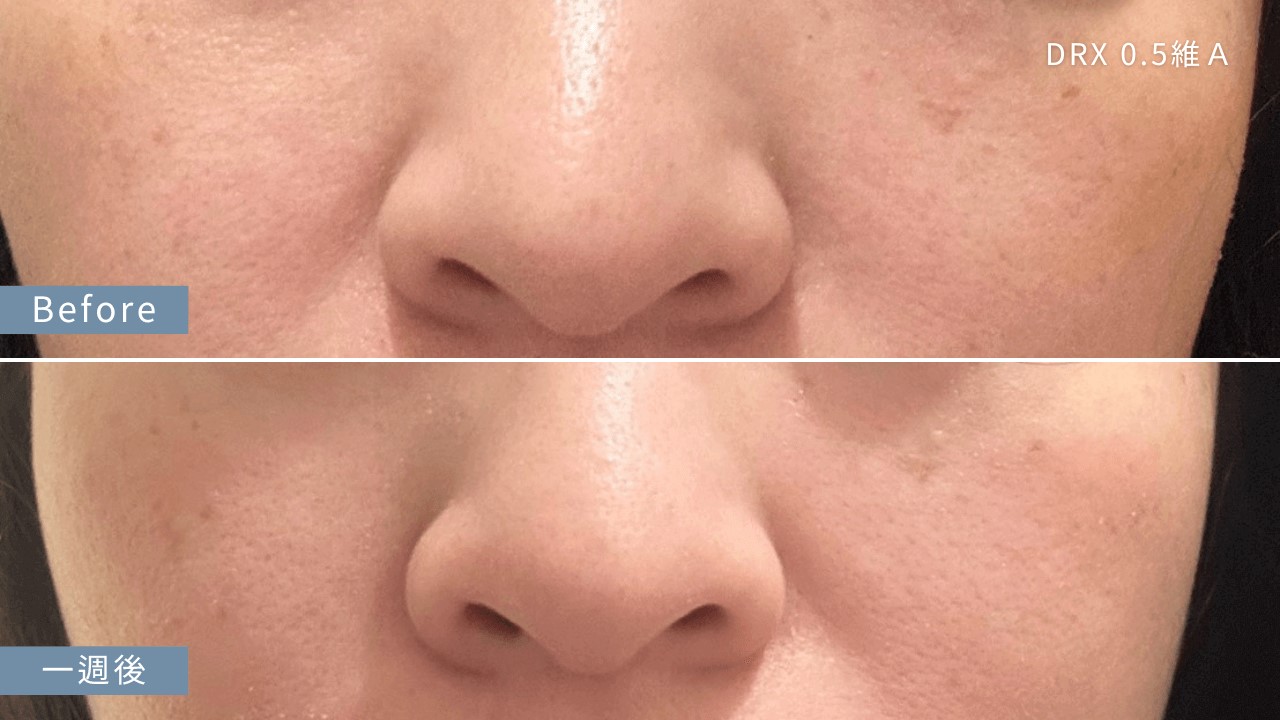 吃什麼變漂亮？掉髮、頭髮乾澀、頭髮變白、臉部暗沉要吃什麼？