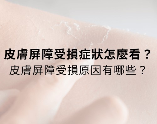 皮膚屏障受損症狀怎麼看?皮膚屏障受損原因有哪些? 皮膚屏障受損症狀怎麼看?皮膚屏障受損原因有哪些?