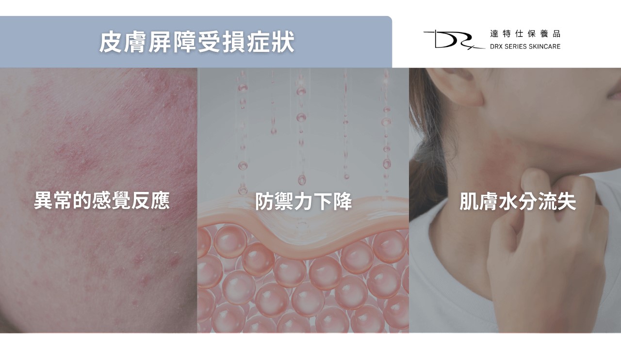 皮膚屏障受損症狀怎麼看?皮膚屏障受損原因有哪些? 皮膚屏障受損症狀怎麼看?皮膚屏障受損原因有哪些?