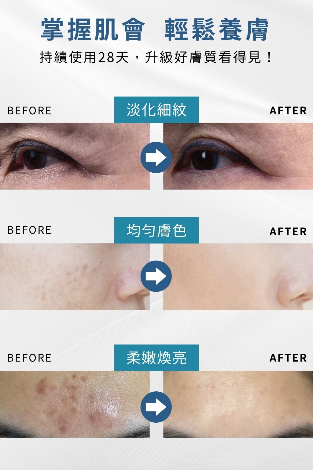 DRX達特仕的莊醫師嚴選活動專區系列-迎新活動 Trifecta 極淨煥活組，痘疤女王莊盈彥醫師專為目標養膚或煥膚抗老打造首席 Trifecta 3冠協作保養！2026年迎新獨家贈6倍全效淨白A醛煥膚 10ml 與 零油光智能防曬慕斯 30ml兩件組。