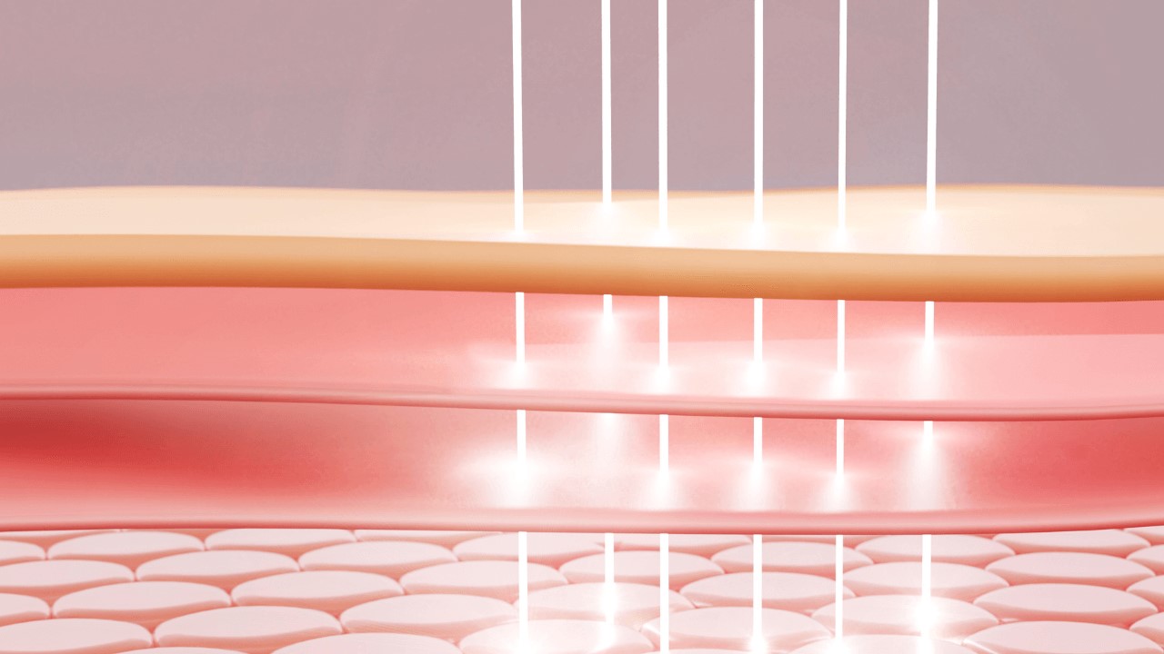 A醇泛紅的原因， A 醇紅腫怎麼辦？