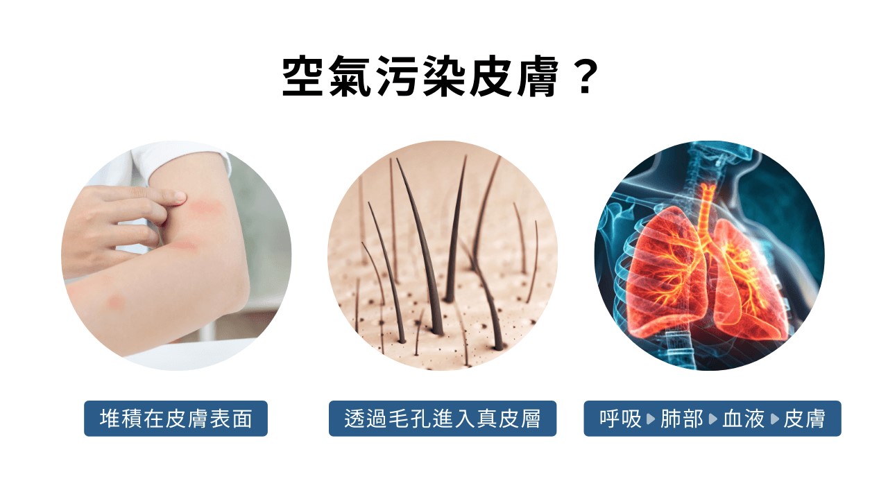 空氣不好會長痘痘嗎?室內空污會漲黑斑、讓皺紋會變多? 空氣不好會長痘痘嗎?室內空污會漲黑斑、讓皺紋會變多?
