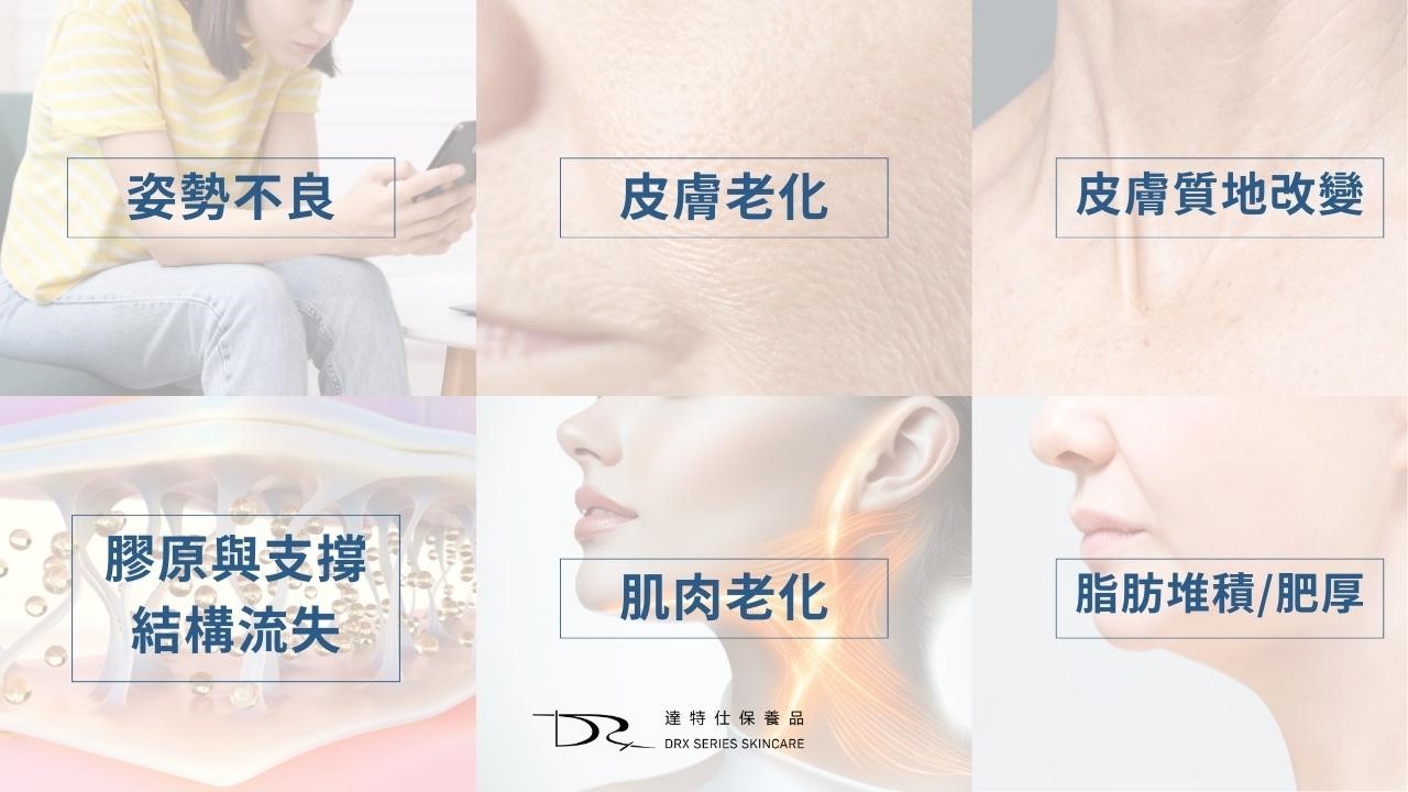 如何消除脖子紋？