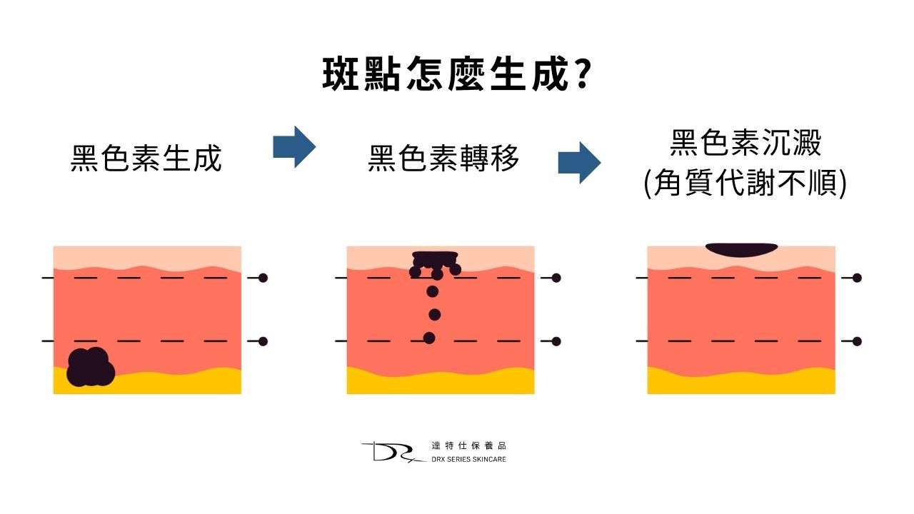 想淡斑看這裡！黑斑保養品、你不知道的11個錯誤淡斑知識一次看！