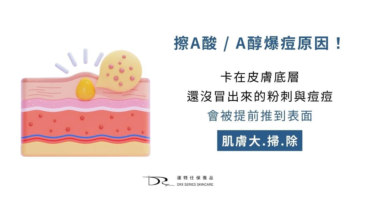 痘痘肌適合什麼化妝水？