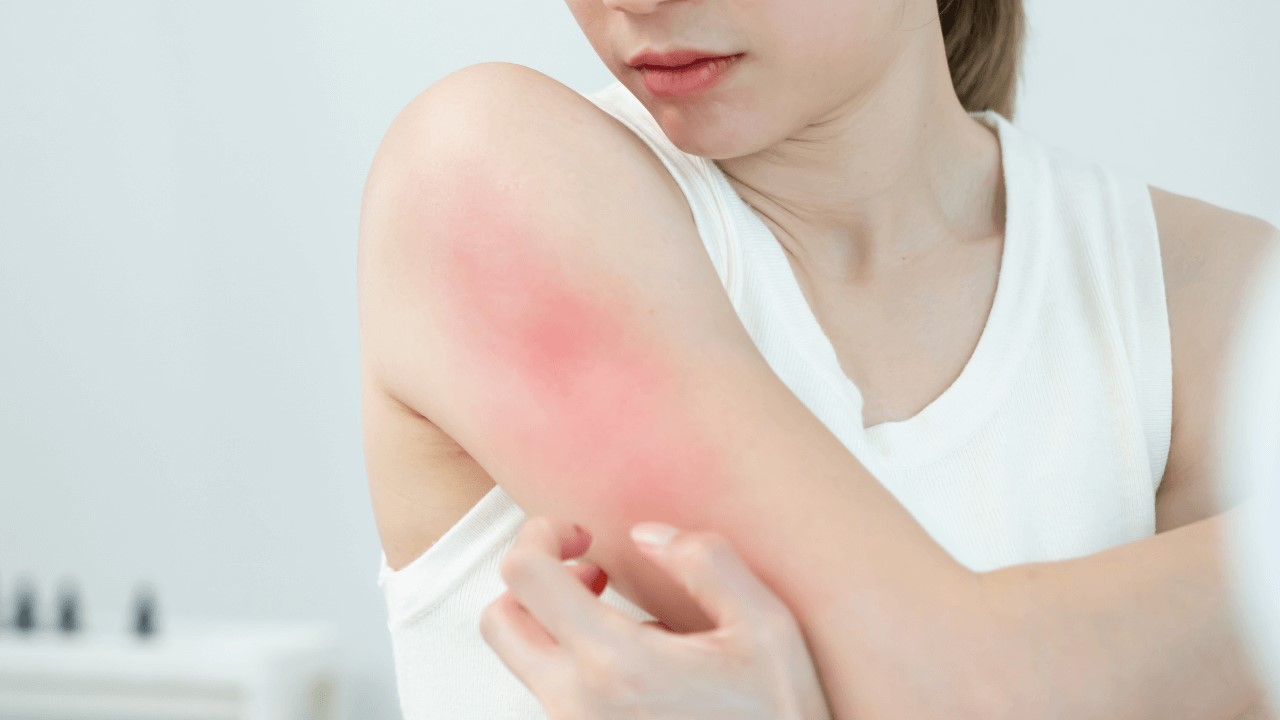 冬天要保濕嗎？乾冷、濕冷保養步驟大公開！