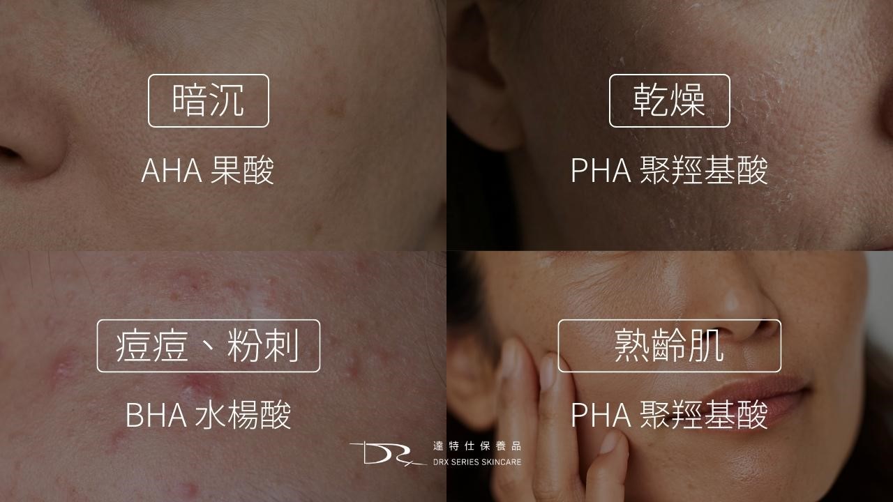 AHA、BHA、PHA 是什麼?新手要選哪一個? AHA、BHA、PHA 是什麼?新手要選哪一個?