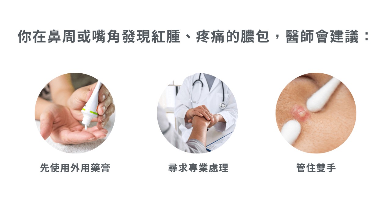 白色痘痘可以擠嗎？哪裡的痘痘不能擠？小心臉部危險三角區！