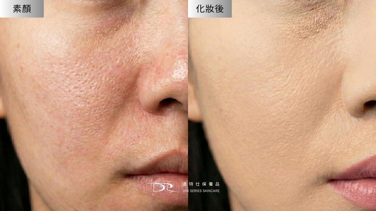 毛孔粗大要擦什麼保養品？