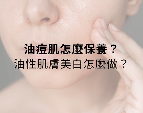 油痘肌怎麼保養？油性肌膚美白怎麼做？