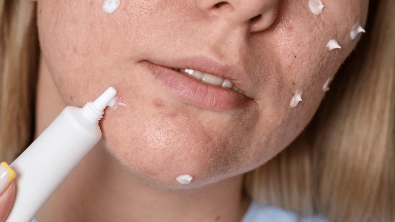 油痘肌怎麼保養？油性肌膚美白怎麼做？