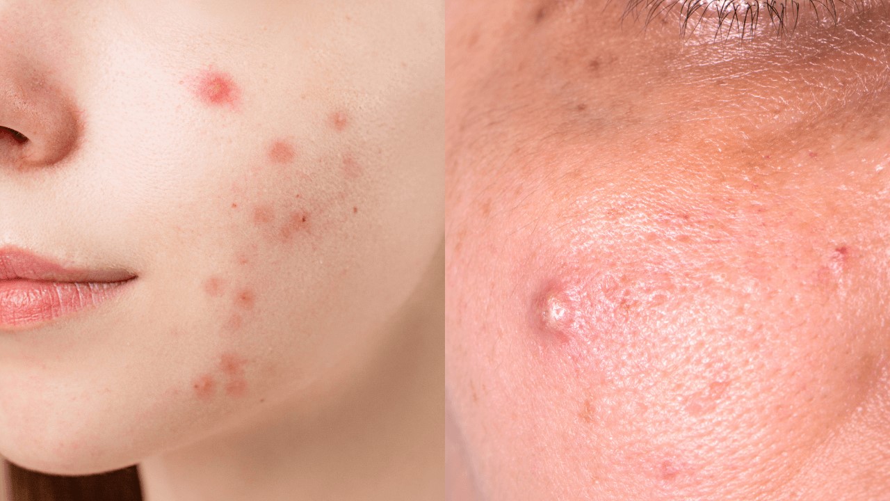 卸妝產品有哪些？卸妝產品怎麼選？