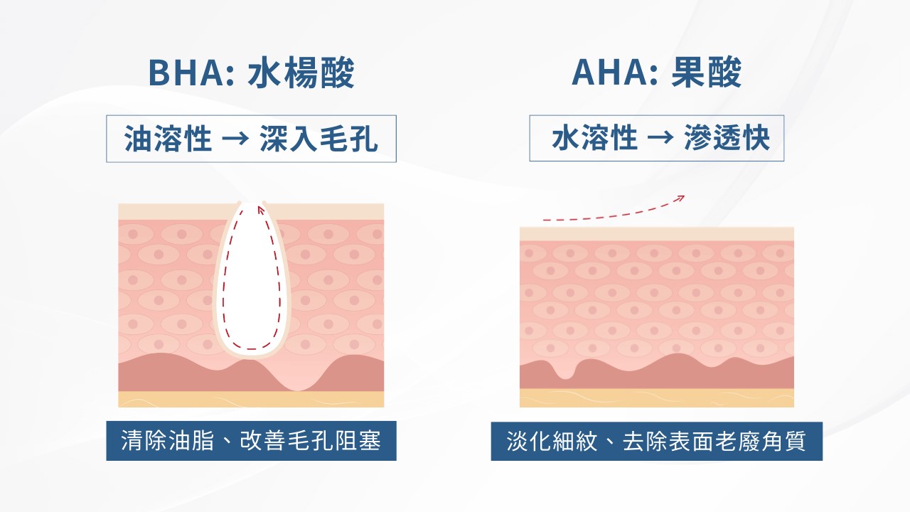 2026水楊酸功效完整解說:水楊酸會縮毛孔嗎? 水楊酸痘痘、水楊酸淡疤,果酸水楊酸差異一次搞懂! 2026水楊酸功效完整解說:水楊酸會縮毛孔嗎? 水楊酸痘痘、水楊酸淡疤,果酸水楊酸差異一次搞懂!