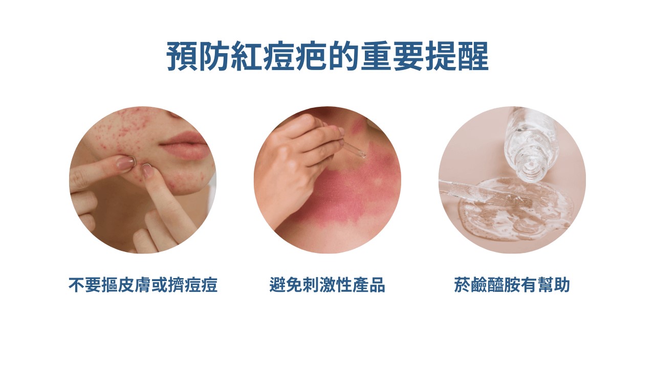 杜鵑花酸、A酸一起用:思媚乳膏用法、思麗安乳膏淡斑?紅痘疤杜鵑花酸保養方式! 杜鵑花酸、A酸一起用:思媚乳膏用法、思麗安乳膏淡斑?紅痘疤杜鵑花酸保養方式!