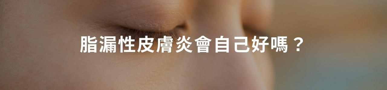 鼻翼為什麼會脫皮?可能是脂漏性皮膚炎! 鼻翼為什麼會脫皮?可能是脂漏性皮膚炎!